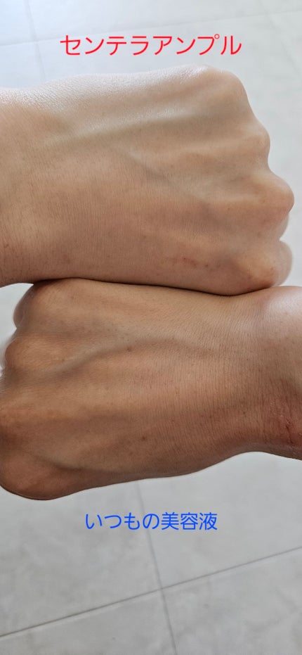 センテラ アンプル/SKIN1004/美容液を使ったクチコミ(2枚目)