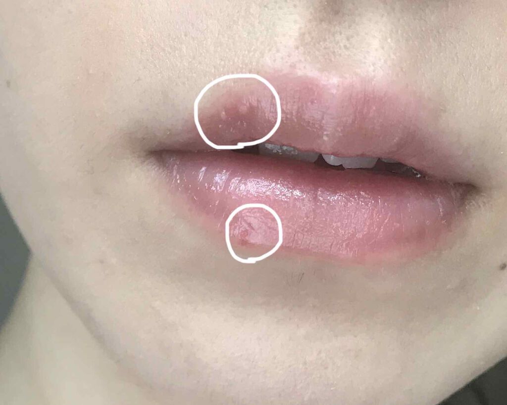 【旧】ディオール アディクト リップ マキシマイザー/Dior/リップグロスを使ったクチコミ(2枚目)