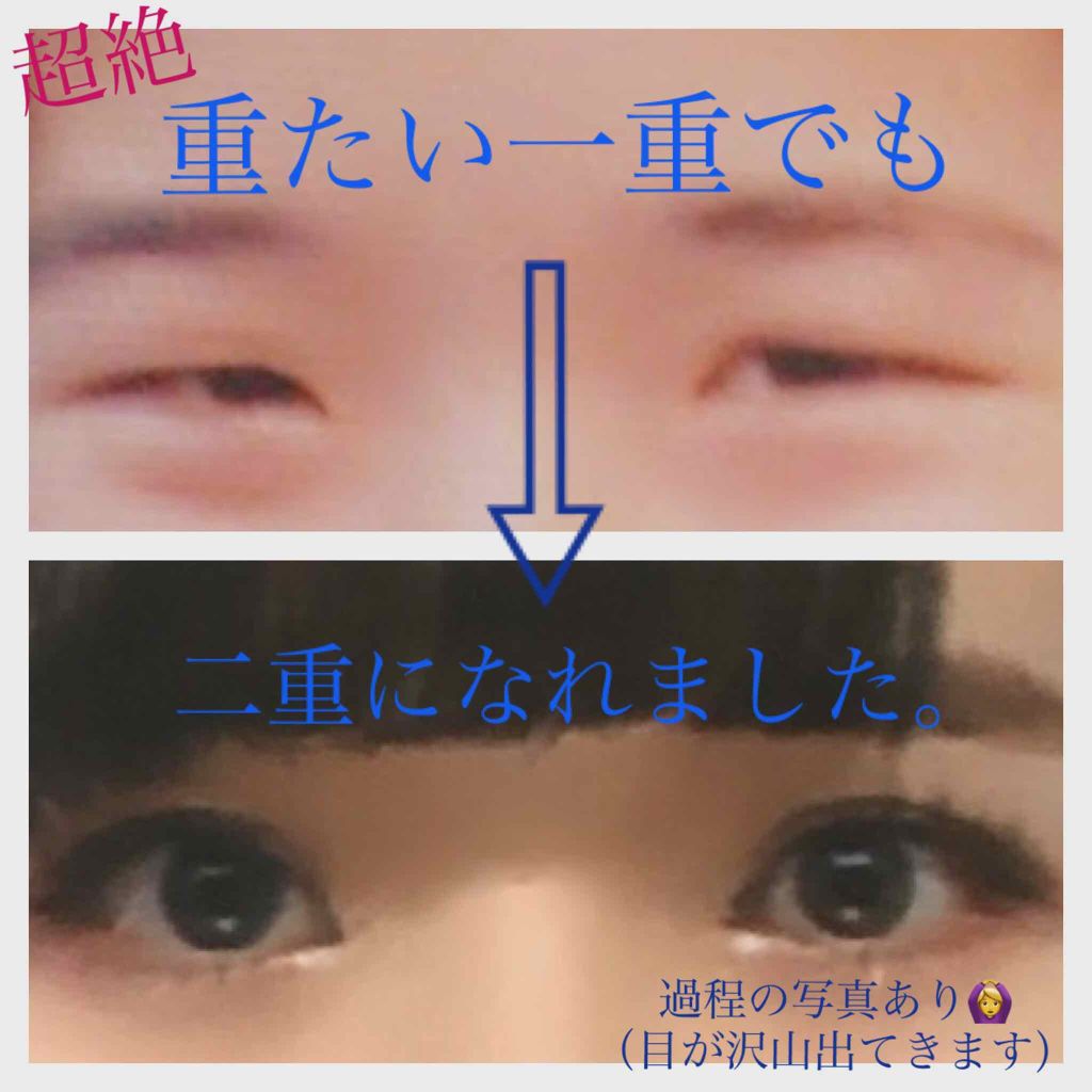 両面二重テープ/DAISO/二重まぶた用アイテムを使ったクチコミ(1枚目)