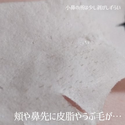 3STEP TAKO PACK NOSE /Nightingale(ナイチンゲール)/シートマスク・パックを使ったクチコミ(6枚目)