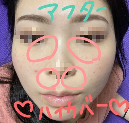 デザイニング コンシーラー/ブリリアージュ/リキッドコンシーラーを使ったクチコミ(5枚目)