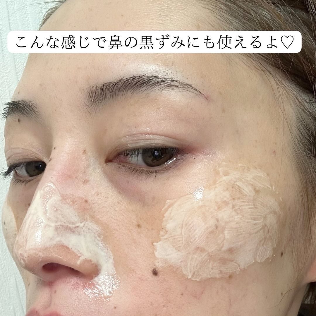 レディブラン 薬用美白シミキールパックC/シーヴァ/ピーリングを使ったクチコミ(6枚目)