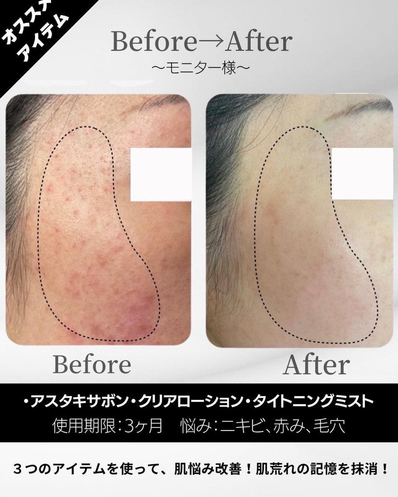 BELA VELA on LIPS 「肌悩み別おすすめBELAVELAアイテム✨今回はそれぞれのア..」(8枚目)