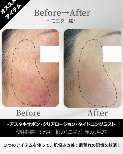 BELA VELA on LIPS 「肌悩み別おすすめBELAVELAアイテム✨今回はそれぞれのア..」(8枚目)