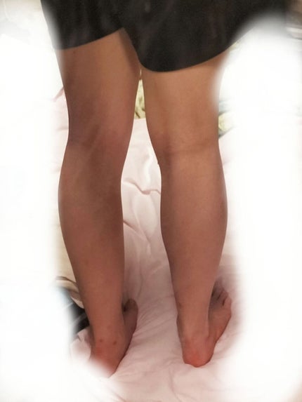 momo ෆ on LIPS 「脚やせ‼️竹脇まりなさん‼️今日も頑張った‼️..」(2枚目)