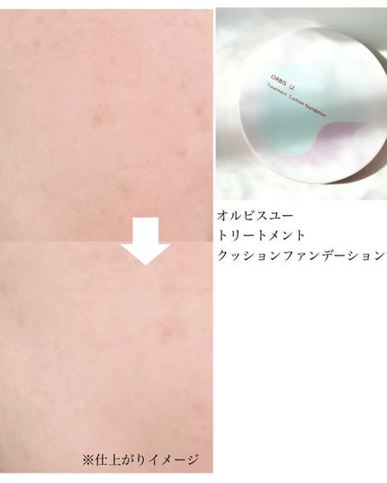 オルビスユー トリートメントクッションファンデーション 専用ケース (限定デザイン)/オルビス/クッションファンデーションの画像