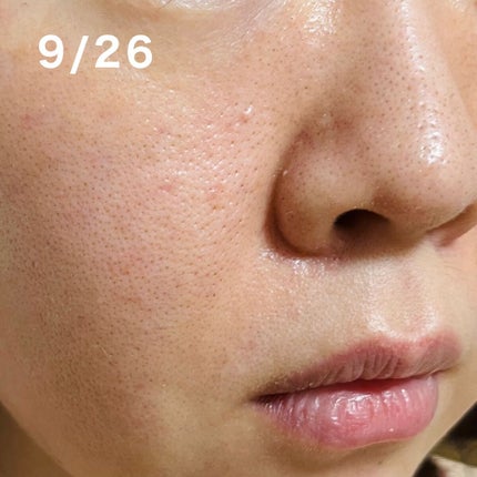 ザ・タイムR アクア/IPSA/化粧水を使ったクチコミ(4枚目)