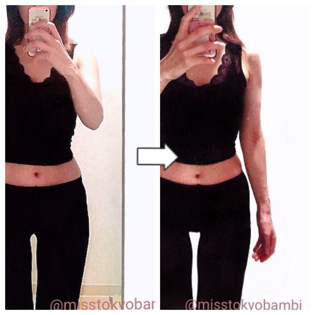 白ゆり@美容ブロガー on LIPS 「【ダイエット181日目】コロナ太りからのやり直しダイエット..」(5枚目)