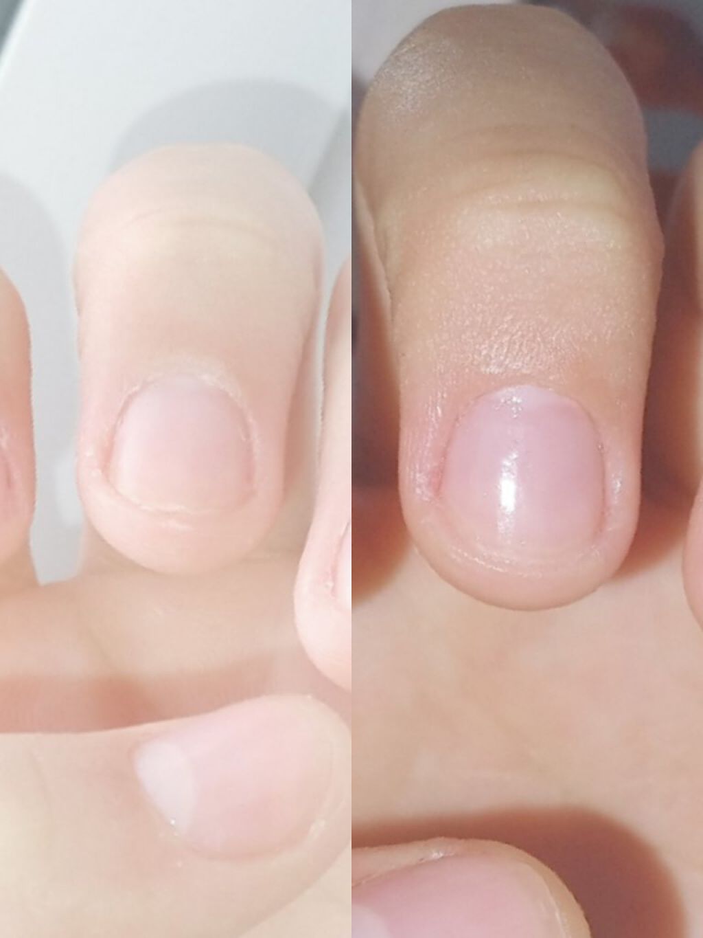 キューティクルオイル/ネイルホリック/ネイルオイル・トリートメントを使ったクチコミ(1枚目)