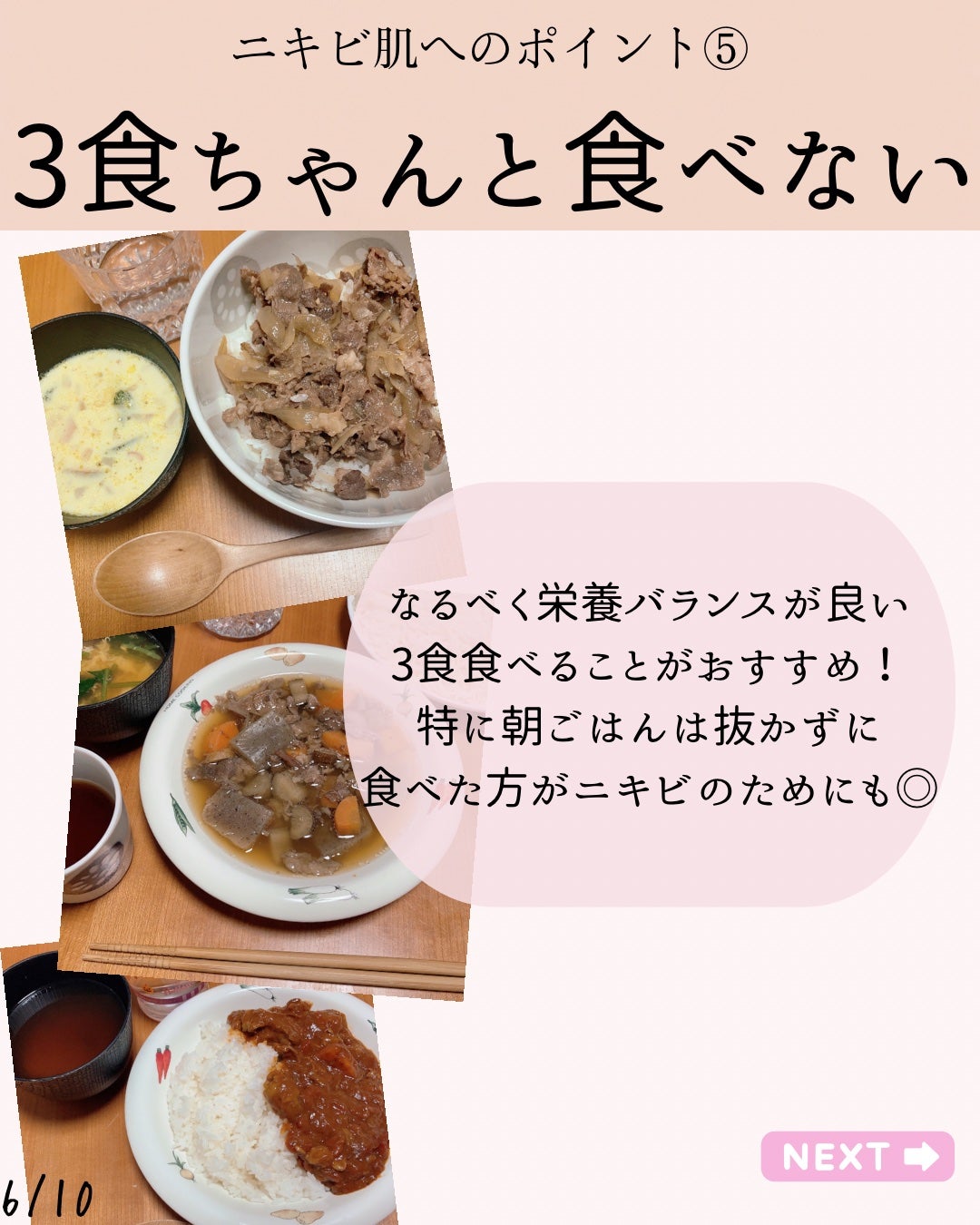 ゆりか│ニキビ肌向けスキンケア解説 on LIPS 「@yurika_nikibi.care👈他ニキビ投稿はこちらこ..」(6枚目)