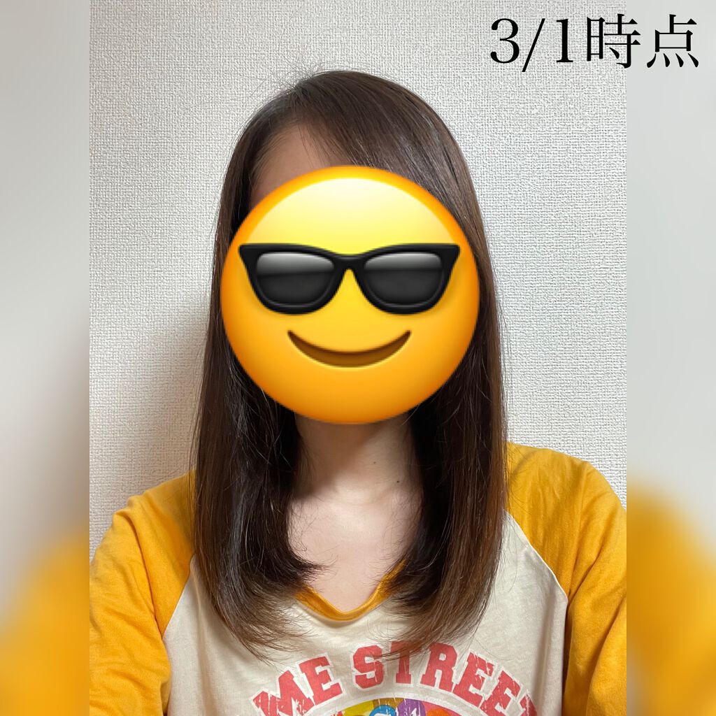 ヘアアクセルレーターEX フローラルアップルの香り/加美乃素本舗/頭皮ローションを使ったクチコミ（3枚目）