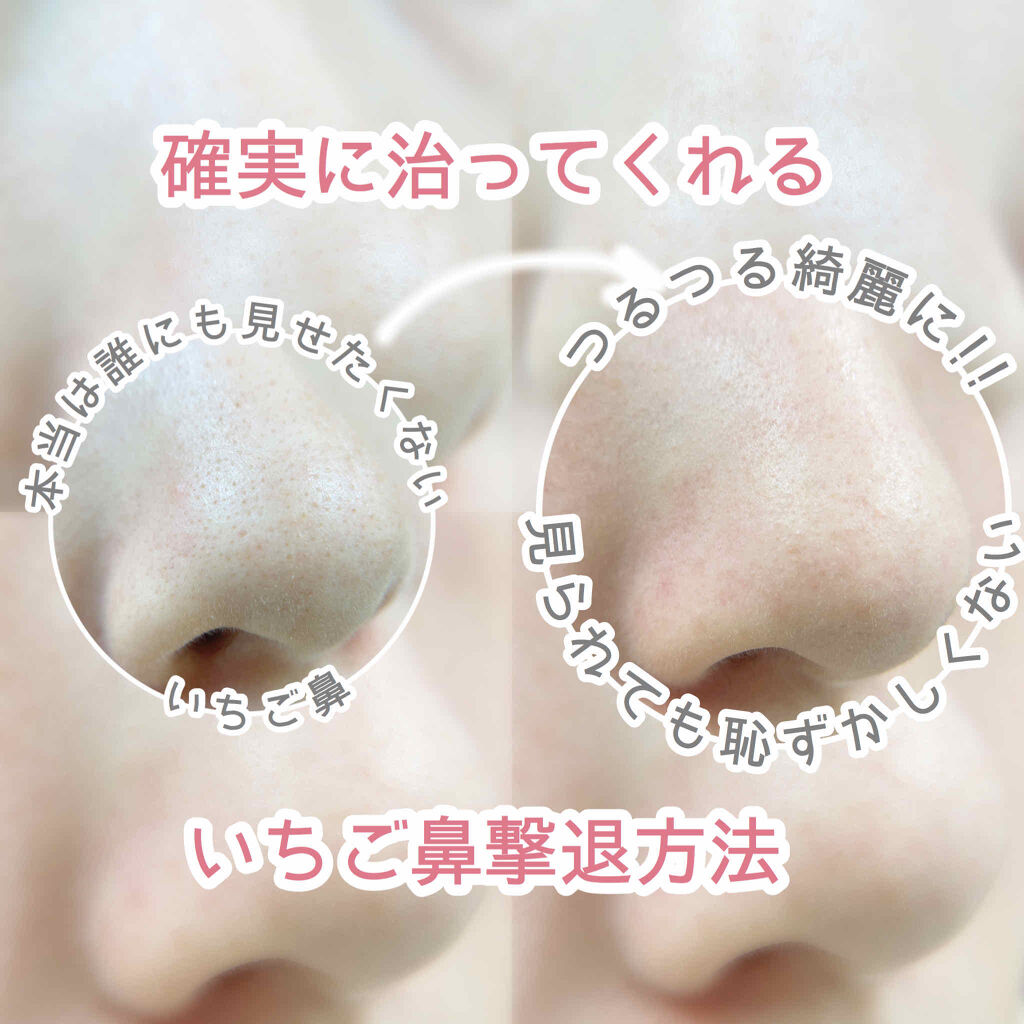 アクアフューチャースキン/アクアフューチャースキン/美顔器・マッサージを使ったクチコミ（1枚目）