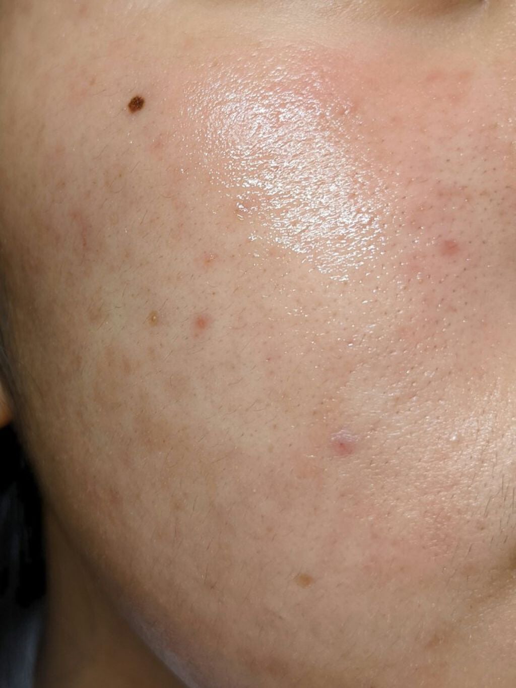 DHC はとむぎエキス/DHC/健康サプリメントを使ったクチコミ(6枚目)