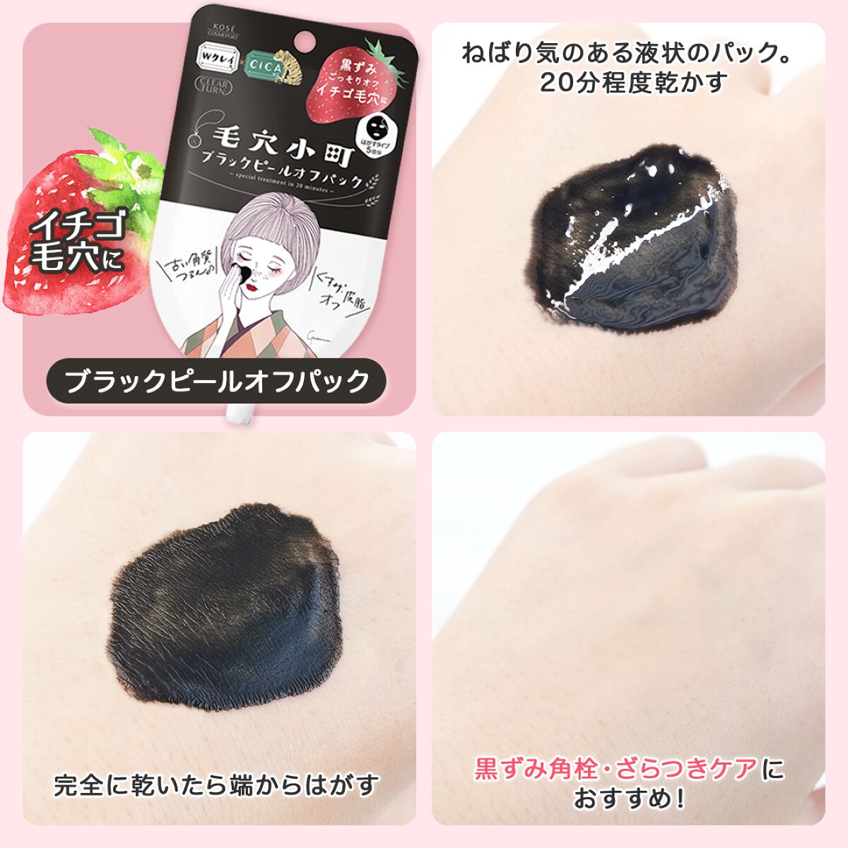 毛穴小町 イエローピールオフパック/クリアターン/ピーリングを使ったクチコミ（2枚目）