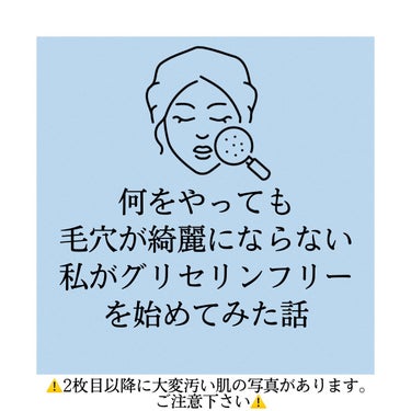 皆さん…

私は今とても感激しています…

今日でグリセリンフリー生活を始めて2週間

私の肌は確実に綺麗になっている‼️

え、ちょっと待って
今まで本っっっっっつ当に何にも効かなかったんです
私の毛