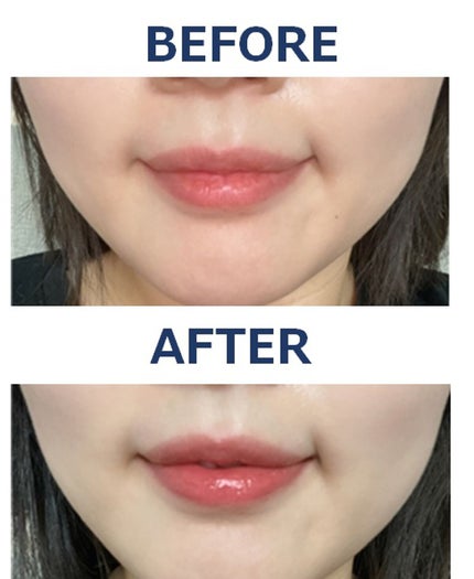 センシュアル ヌードバーム/HERA/リップバームを使ったクチコミ(3枚目)