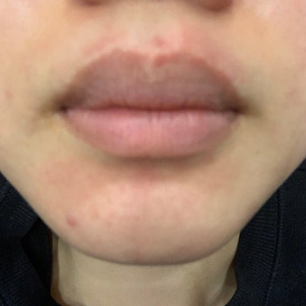 space on LIPS 「行事が始まり、ストレスでニキビが増え、、、疲れと生理ででお菓子..」(4枚目)