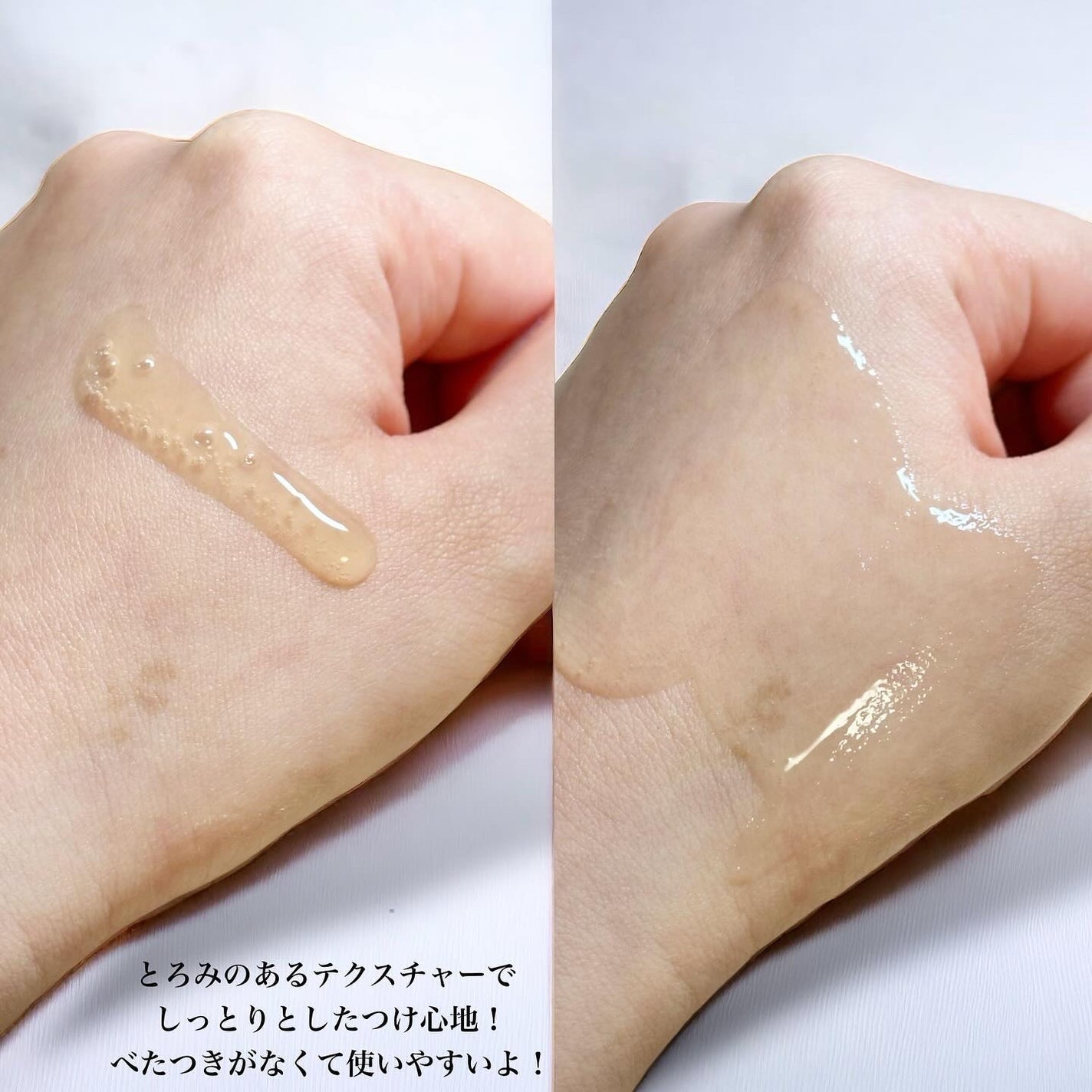 AGE-Rスキンブースターショット/MEDICUBE/美顔器・マッサージを使ったクチコミ(7枚目)