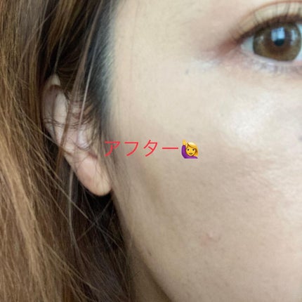 カバーナチュール/アンジエンド/クリームコンシーラーを使ったクチコミ(6枚目)