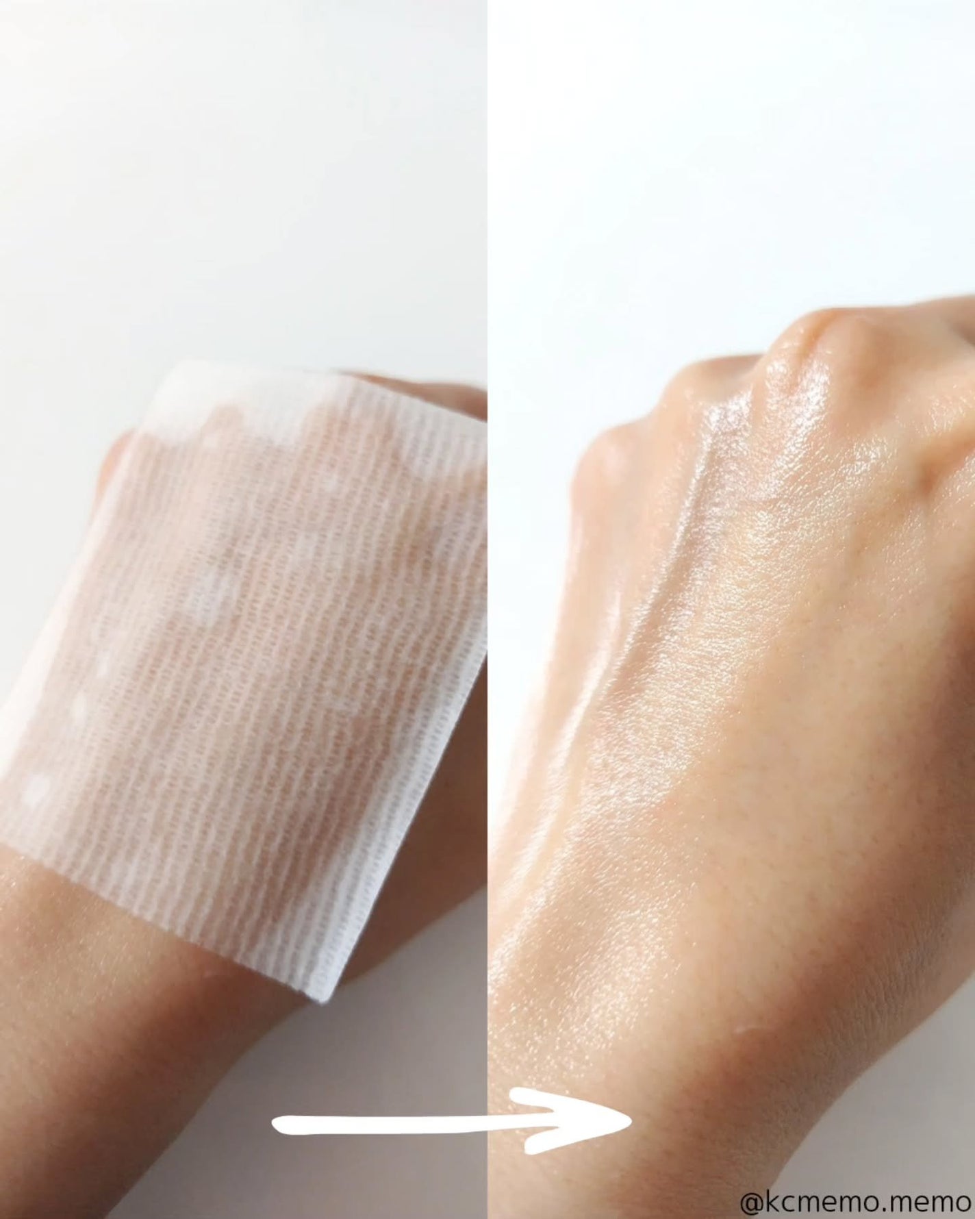 メラケアゼリータッチデュアルパッド/Genabelle/トナーパッドを使ったクチコミ(4枚目)