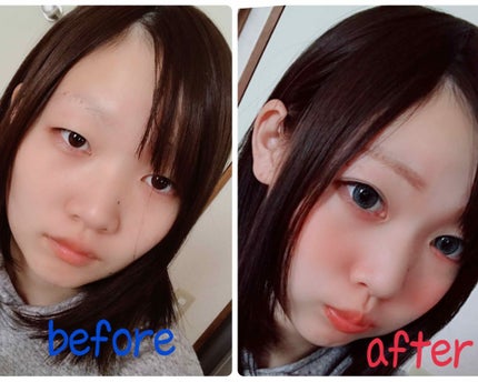 二重まぶた用シール/DAISO/二重まぶた用アイテムを使ったクチコミ(1枚目)