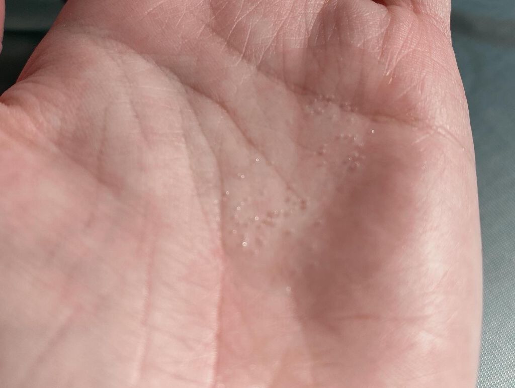 リフトホワイト ローション モイスト/BRIGHTAGE/化粧水を使ったクチコミ（3枚目）