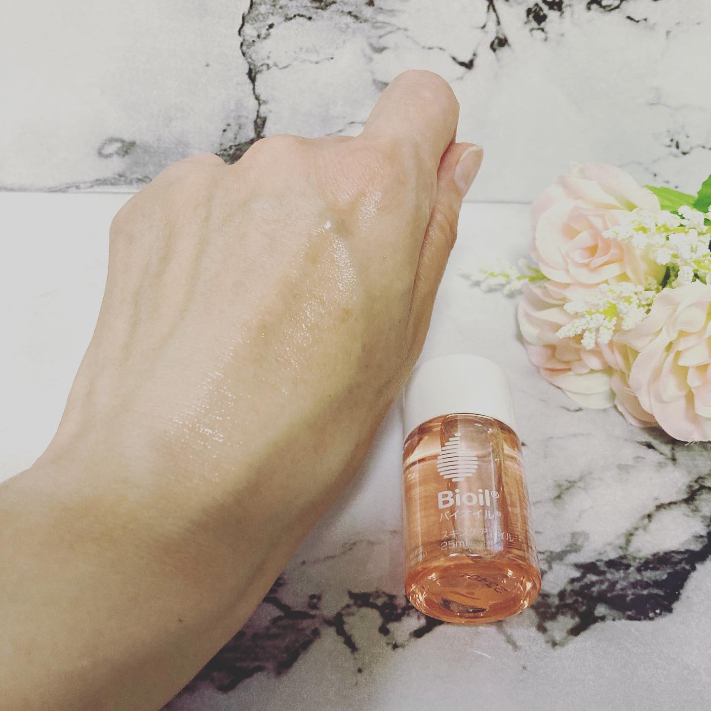 バイオイル/バイオイル/フェイスオイルを使ったクチコミ（3枚目）