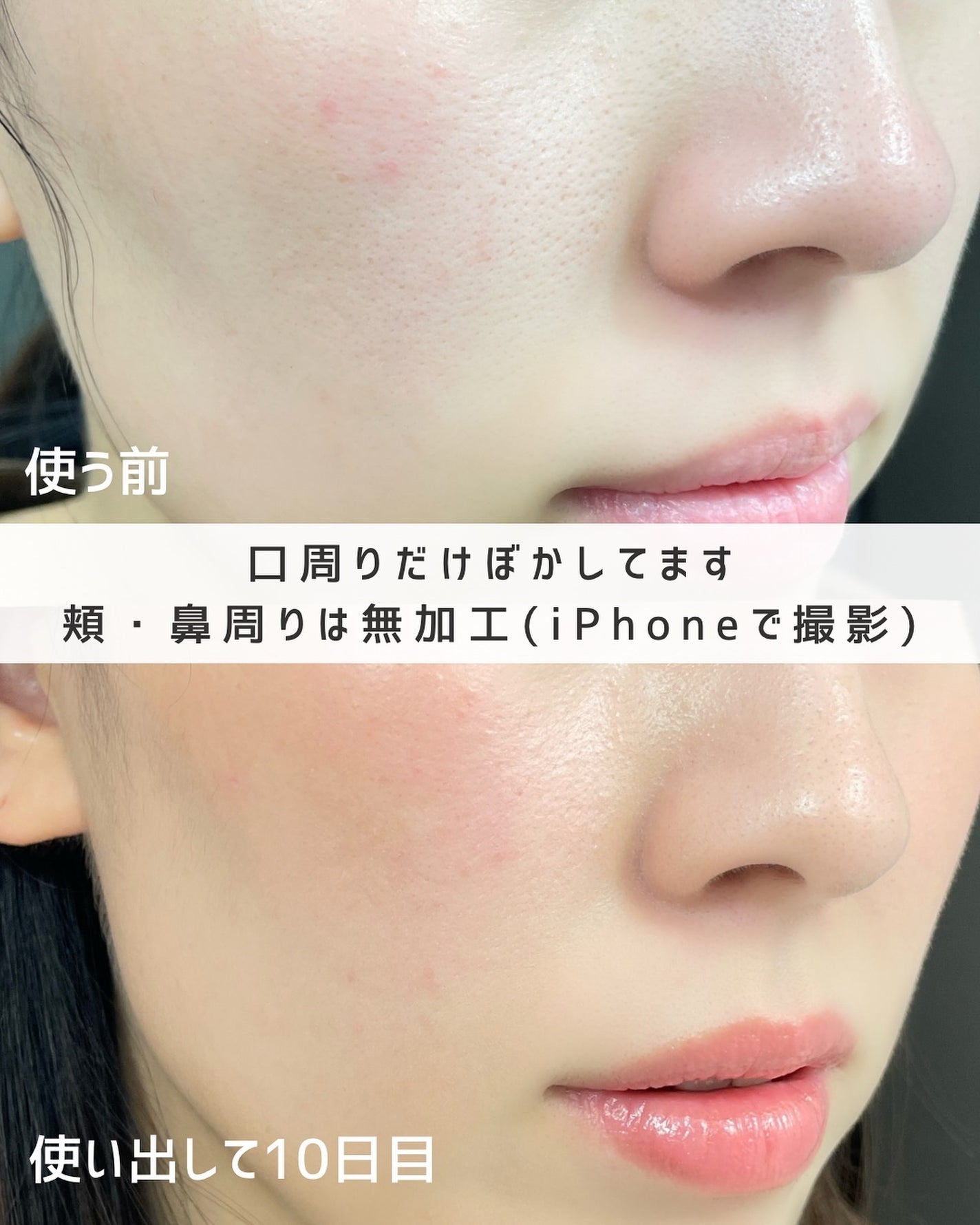 カロテンIPMP(TM) とろけるクレンジングバーム /APRILSKIN/クレンジングバームを使ったクチコミ(5枚目)