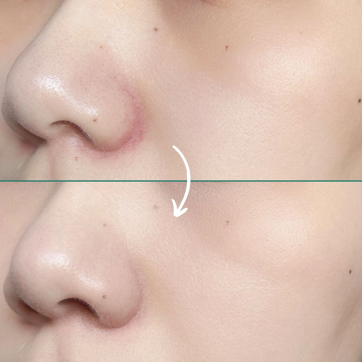 スーパーシカクッション/MEDICUBE/クッションファンデーションを使ったクチコミ(4枚目)