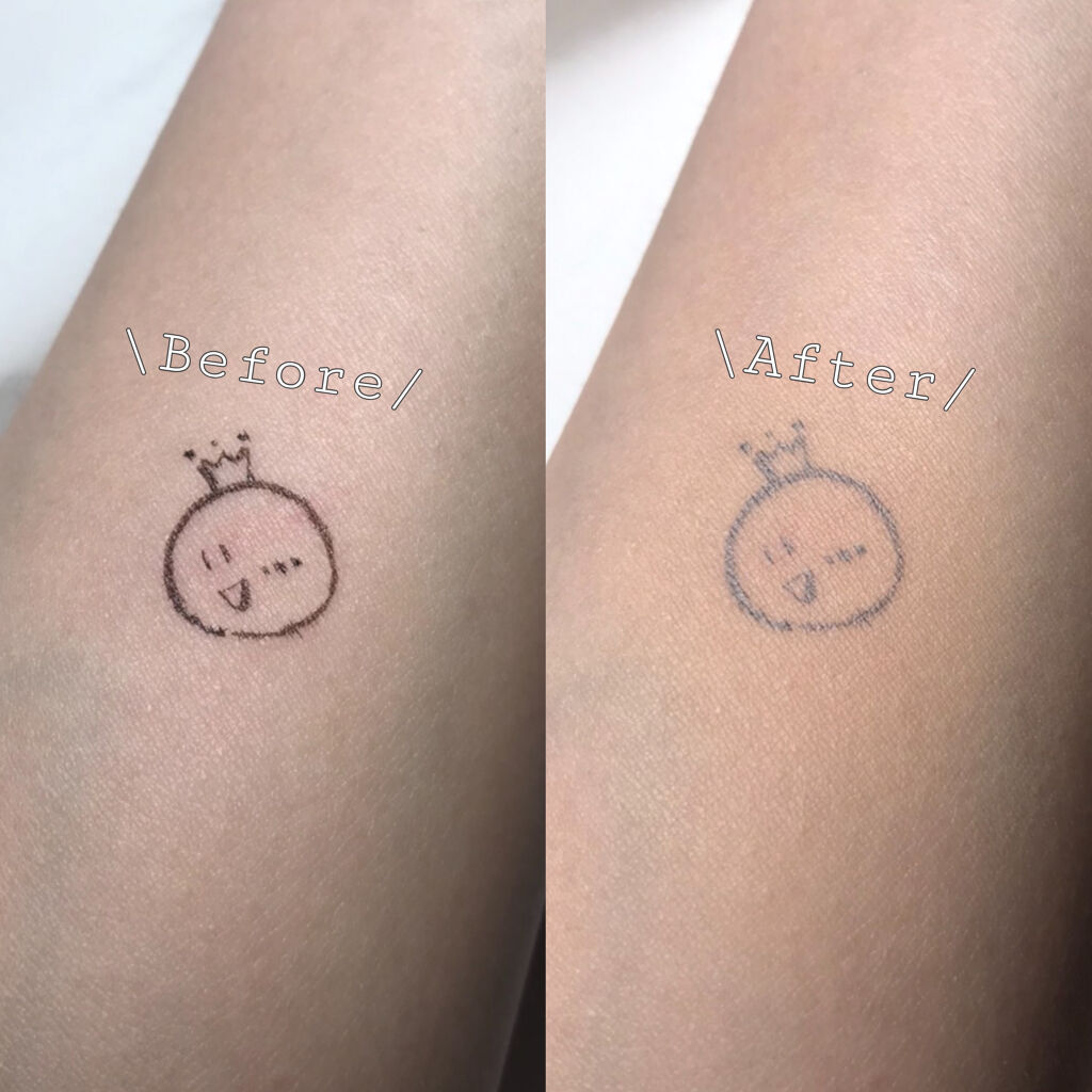 【旧】ディオールスキン フォーエヴァー スキン コレクト コンシーラー/Dior/リキッドコンシーラーを使ったクチコミ（2枚目）