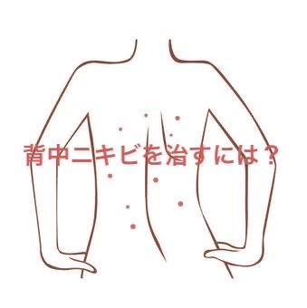 ニキビを防ぐ薬用石鹸 ForBack/ペリカン石鹸/ボディ石鹸を使ったクチコミ（1枚目）