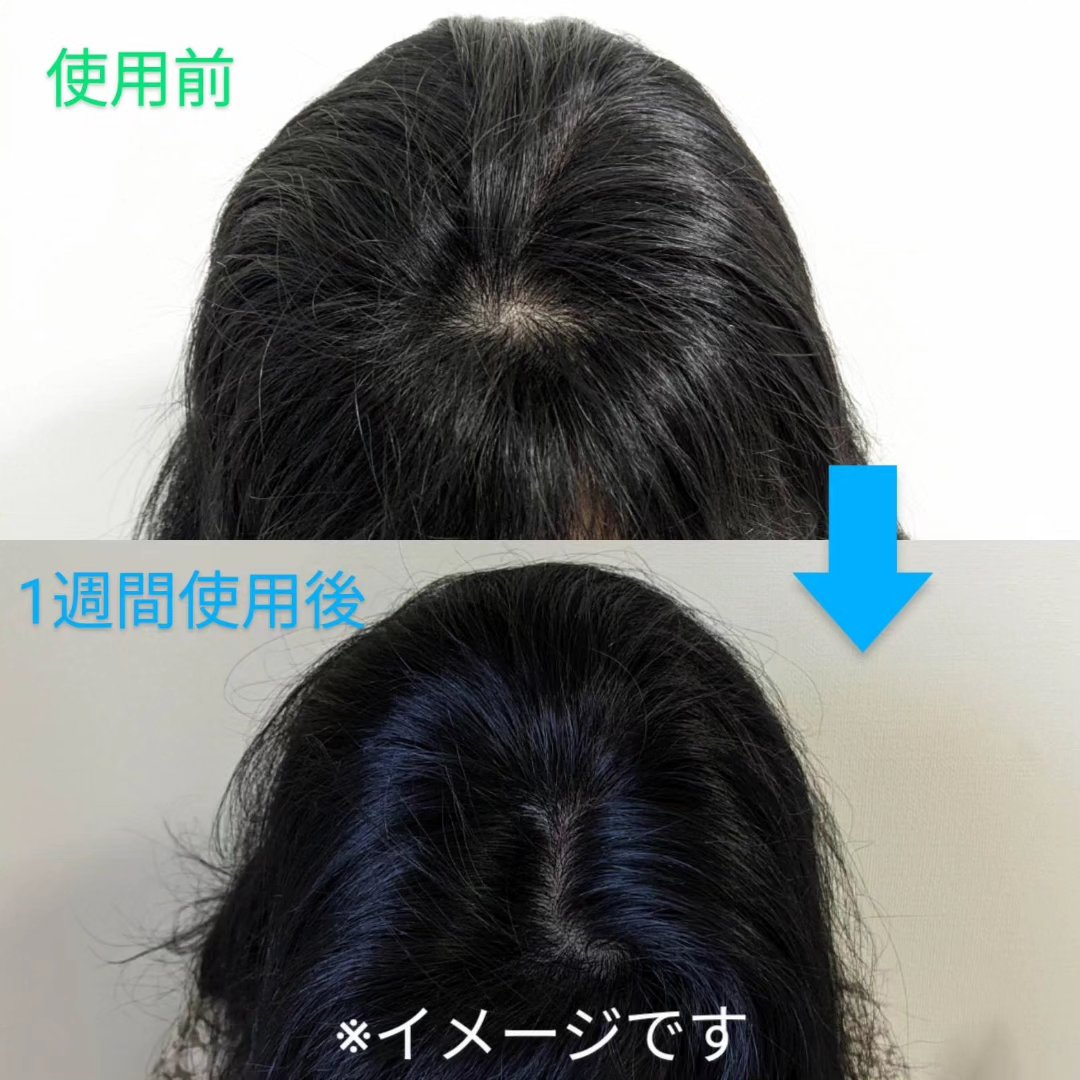 薬用育毛剤 KAMINOWA/KAMINOWA/頭皮ローションを使ったクチコミ（2枚目）