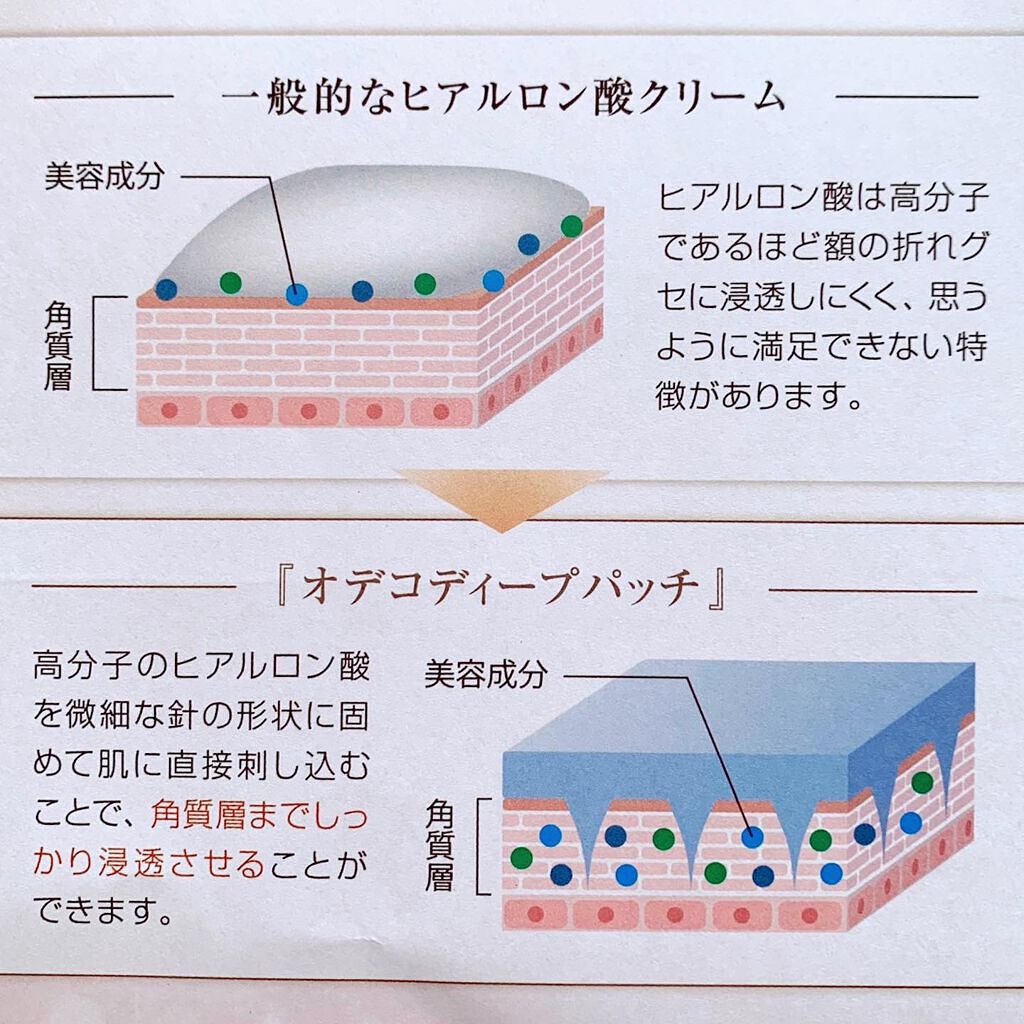 オデコディープパッチ/北の快適工房/シートマスク・パックを使ったクチコミ(7枚目)