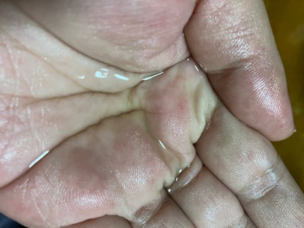 VC100エッセンスローション EX/ドクターシーラボⓇ/化粧水を使ったクチコミ(2枚目)