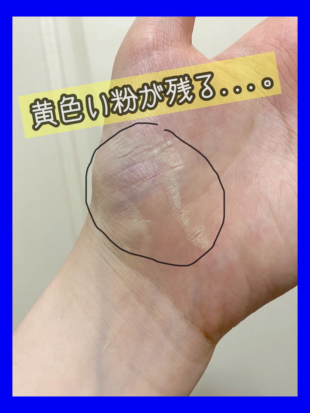 アクネローション/メンターム/化粧水を使ったクチコミ（3枚目）