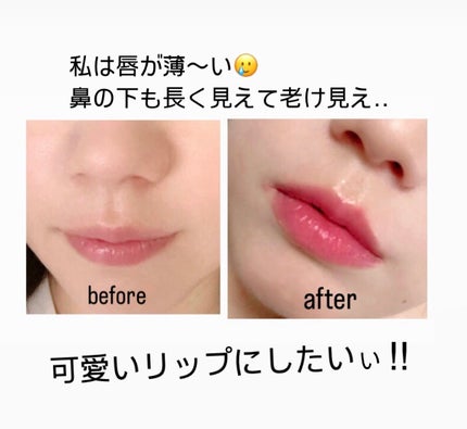 yuka on LIPS 「唇ボリュームアップ法💋①リップライナーで口の山と下を囲む②赤ピ..」(2枚目)