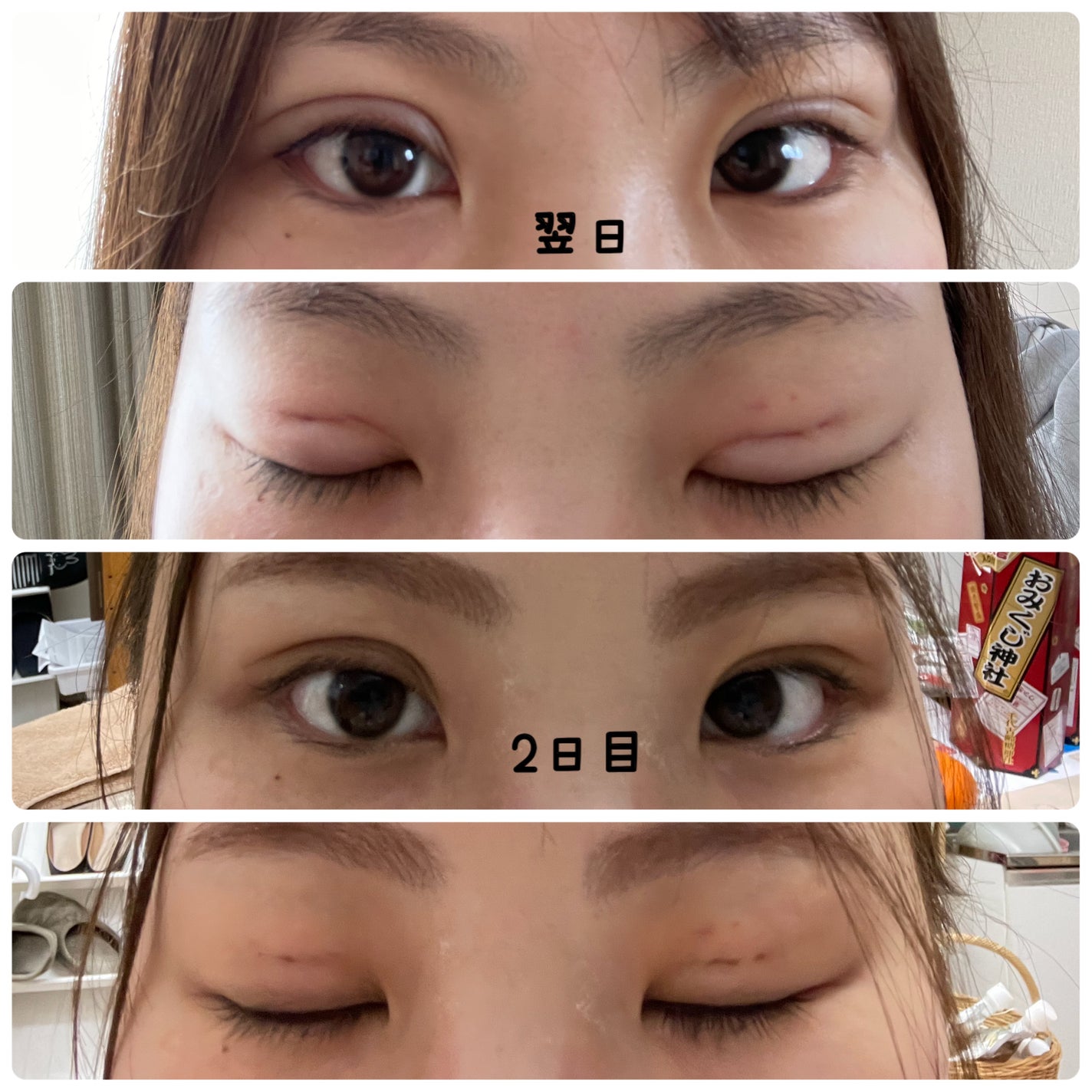 ナイトアイボーテ/StreeTrend/二重まぶた用アイテムを使ったクチコミ(5枚目)