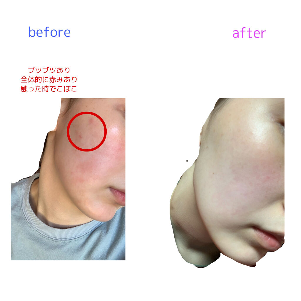 を使ったクチコミ（3枚目）