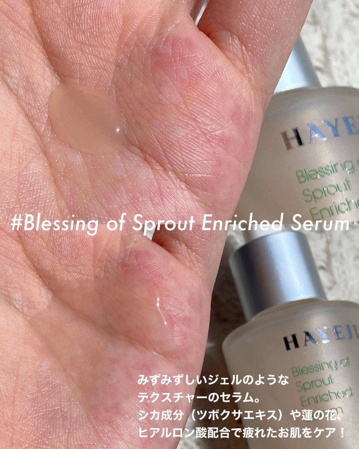 プレッシングオブスプラウトトナー/ハイジェン/化粧水を使ったクチコミ(5枚目)