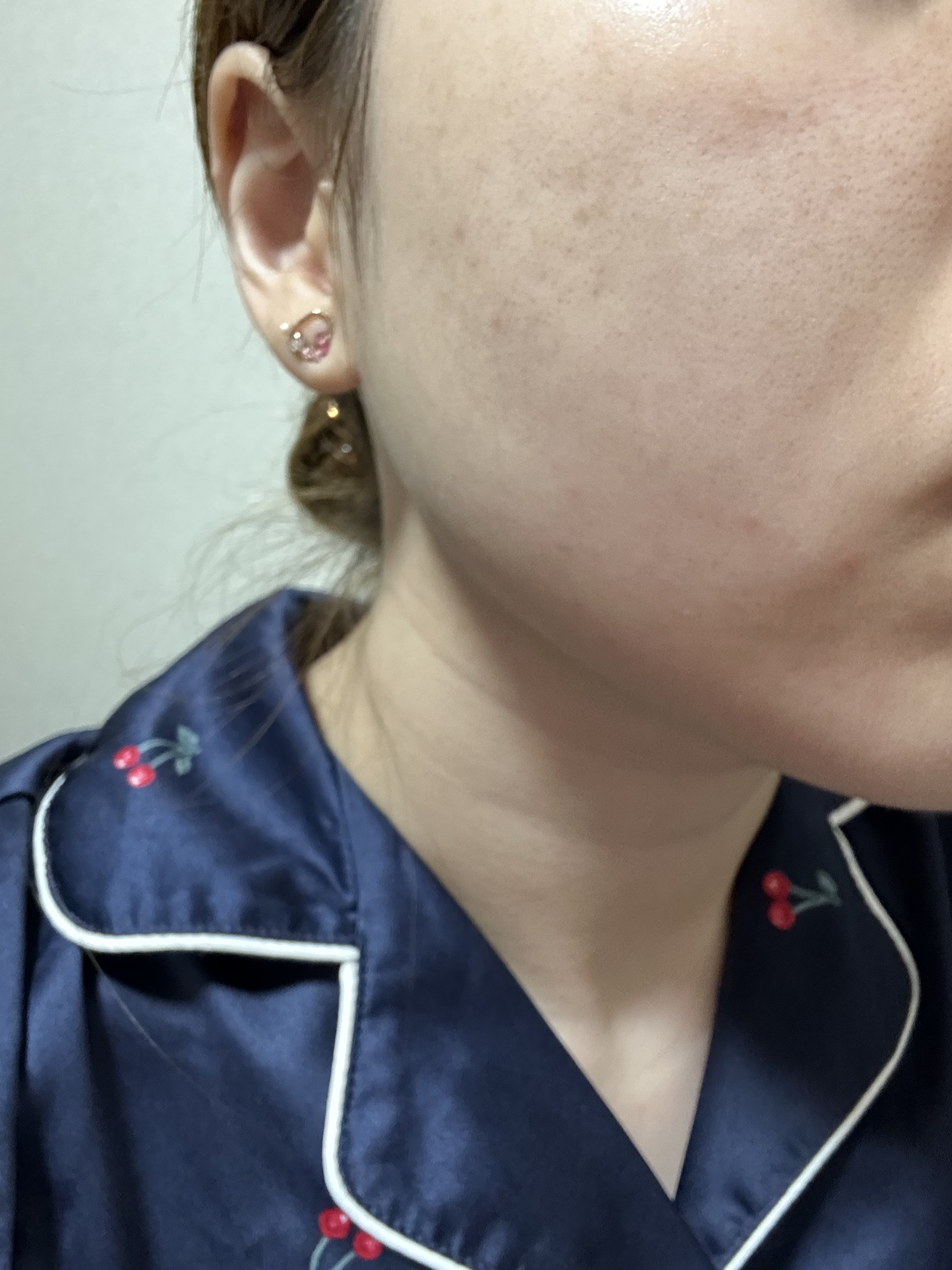 リアルカロテンブレミッシュクリアビタパッド/APRILSKIN/トナーパッドを使ったクチコミ（2枚目）