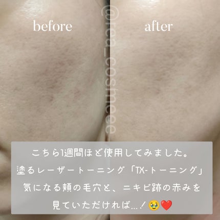 リードルショット100/VT/美容液を使ったクチコミ(6枚目)