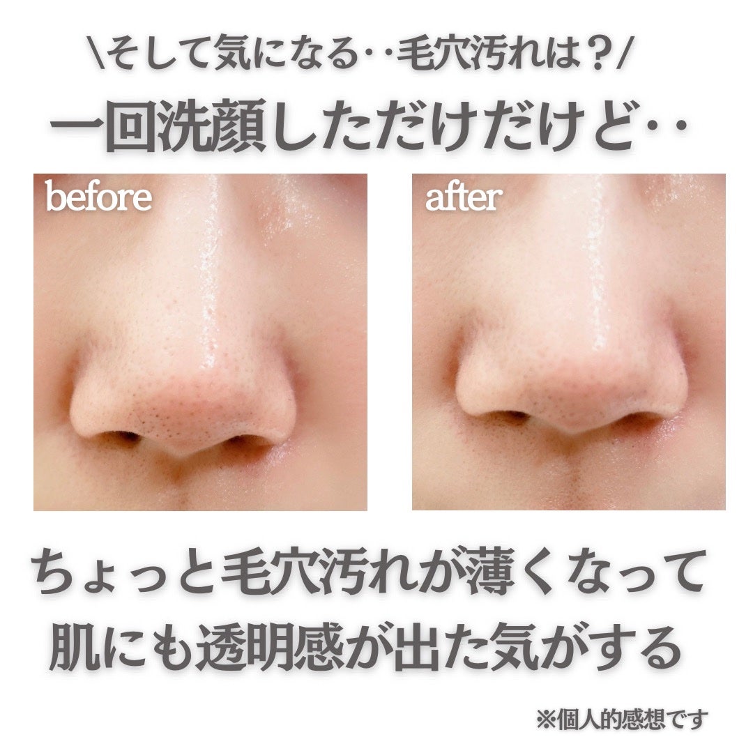 sapi@フォロバ100 on LIPS 「溢れる透明感/ブラック泡で毛穴ケア!墨洗顔!!--------..」(5枚目)