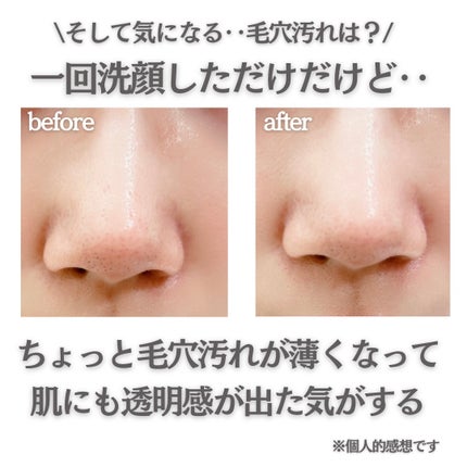 sapi@フォロバ100 on LIPS 「溢れる透明感/ブラック泡で毛穴ケア!墨洗顔!!--------..」(5枚目)