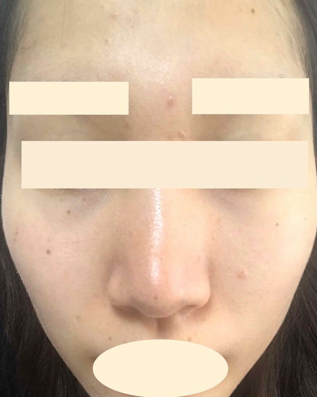 アスタリフト ホワイト エッセンス インフィルト/アスタリフト/美容液を使ったクチコミ(1枚目)