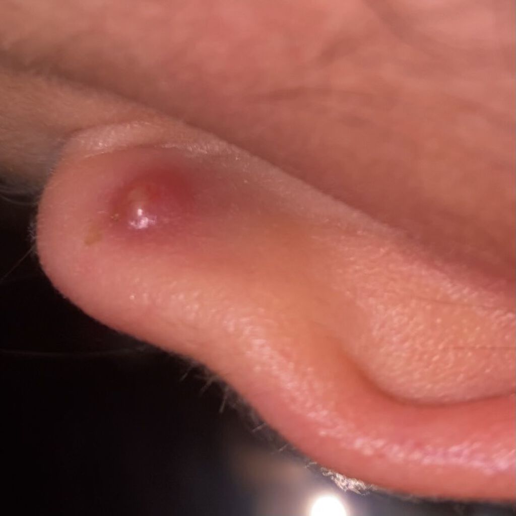 マキロンs （医薬品）/マキロン/その他を使ったクチコミ（2枚目）