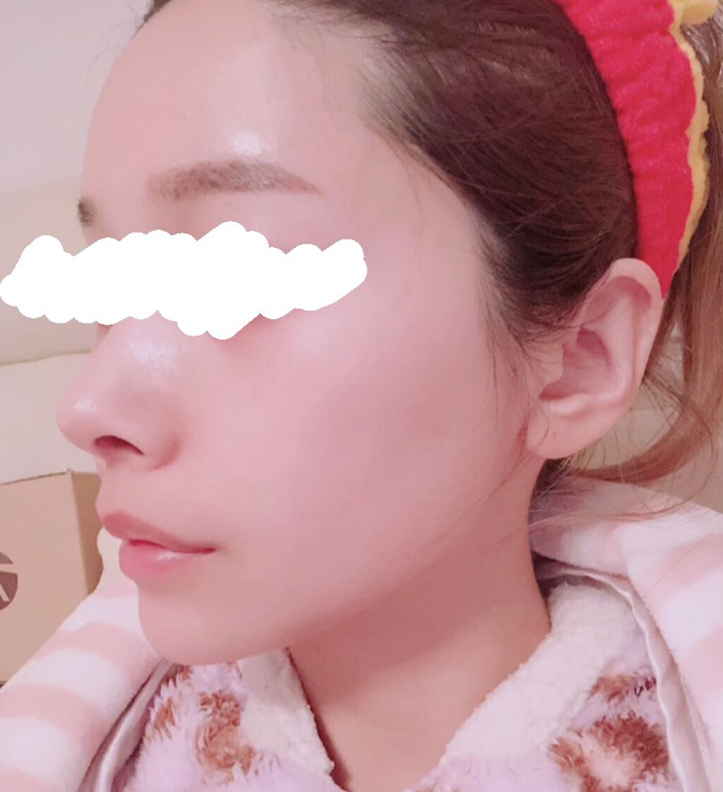  クリアクレイフォンデュ/DEW/洗い流すパック・マスクを使ったクチコミ（3枚目）