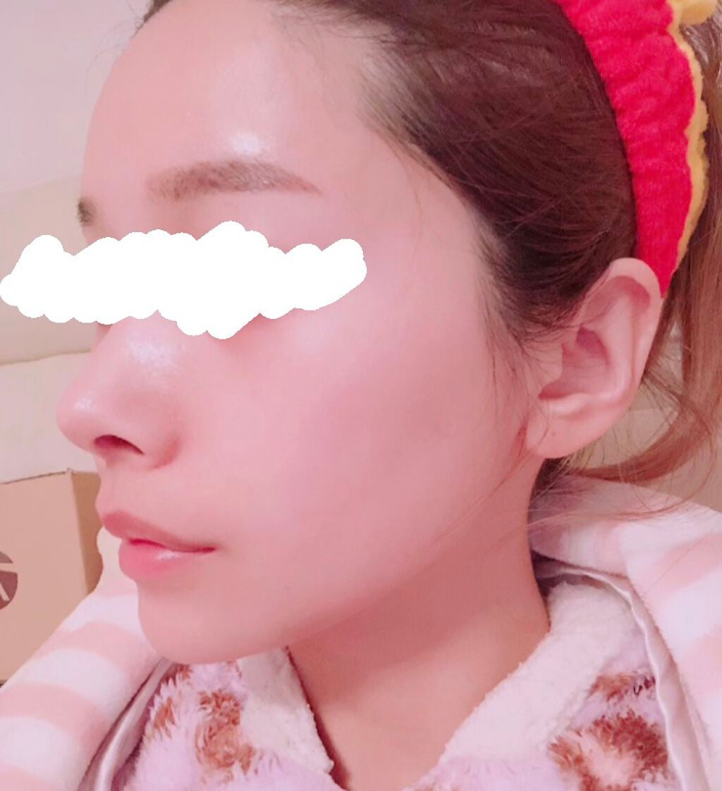 クリアクレイフォンデュ/DEW/洗い流すパック・マスクを使ったクチコミ(3枚目)