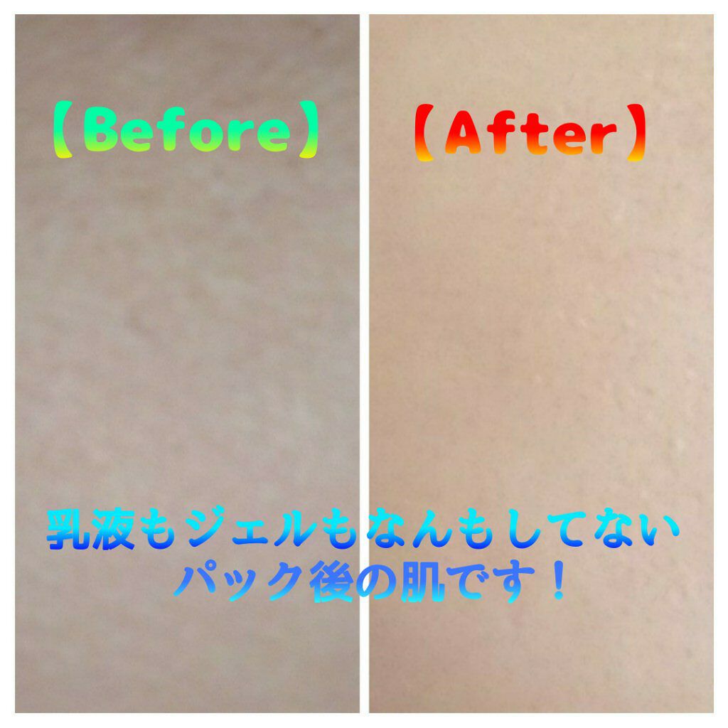 ハトムギ化粧水(ナチュリエ スキンコンディショナー R )/ナチュリエ/化粧水を使ったクチコミ(4枚目)