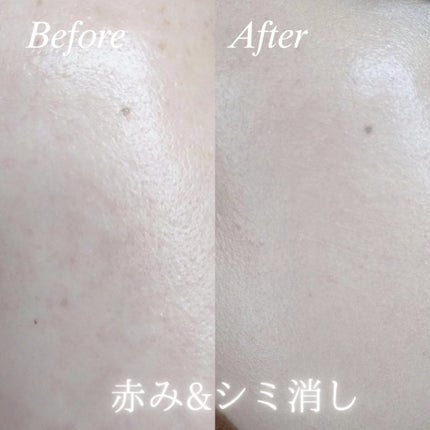 ピンクティーツリーカバーアップグロウクッション/APLIN/クッションファンデーションを使ったクチコミ(2枚目)