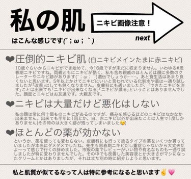 薬用クリア化粧水/メンソレータム アクネス/化粧水を使ったクチコミ（3枚目）